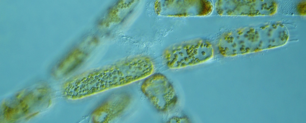 Stephanopyxis turris